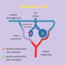 Image result for  v    q