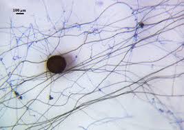 Attēlu rezultāti vaicājumam “Didymium aggregatum spores”