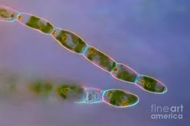 Attēlu rezultāti vaicājumam “Trentepohlia sp.”