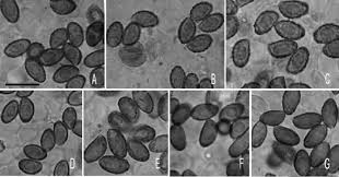 Attēlu rezultāti vaicājumam “Claustria didermoides spores”