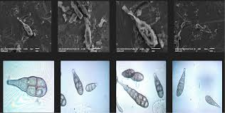 Attēlu rezultāti vaicājumam “Heterotrichia oerstedii (syn. Arcyria oerstedii) spores”