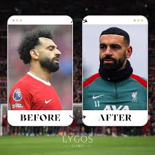 Image result for Liverpool Transplant FC