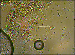 Attēlu rezultāti vaicājumam “Lecanora conizaeoides”