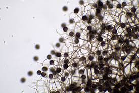 Attēlu rezultāti vaicājumam “Lamproderma elasticum spores”