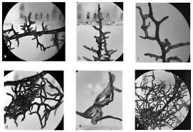 Attēlu rezultāti vaicājumam “Enteridium corticatum”