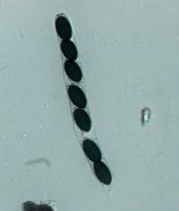 Attēlu rezultāti vaicājumam “Sordaria fimicola”