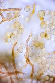 Attēlu rezultāti vaicājumam “Trichia erecta spores”