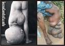 Memórias e outras histórias...: As 10 <b>doenças</b> mais estranhas do mundo