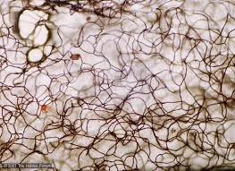 Attēlu rezultāti vaicājumam “Arcyria affinis spores”