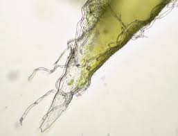 Attēlu rezultāti vaicājumam “Hedwigia ciliata sporophyte”