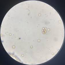 Attēlu rezultāti vaicājumam “Stemonitis virginiensis spores”