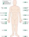 <b>Systemic Scleroderma</b>