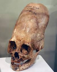 Image result for elongated skulls