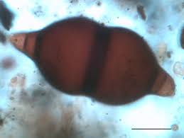 Attēlu rezultāti vaicājumam “Cribraria costata spores”
