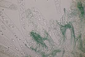 Attēlu rezultāti vaicājumam “Octosporella jungermanniarum”