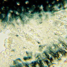 Attēlu rezultāti vaicājumam “Megalaria grossa”