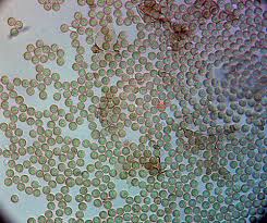 Attēlu rezultāti vaicājumam “Symphytocarpus impexus spores”