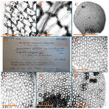 Attēlu rezultāti vaicājumam “Jungermannia hyalina cells”