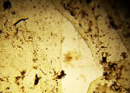 Attēlu rezultāti vaicājumam “Chaetophora pisiformis”