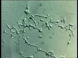 Attēlu rezultāti vaicājumam “Stemonitis flavogenita”