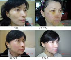 http://t0.gstatic.com/images?q=tbn:ANd9GcSazYHwMMLyg75biqv55rJ7o4BAO-dF-ggdNno4_d5sq3u4OW65