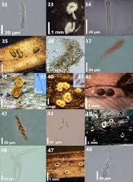 Attēlu rezultāti vaicājumam “Lachnum virgineum”