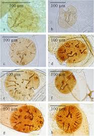 Attēlu rezultāti vaicājumam “Stemonitopsis aequalis var. microspora spores”