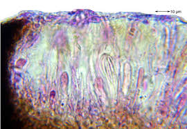 Attēlu rezultāti vaicājumam “Alyxoria varia”