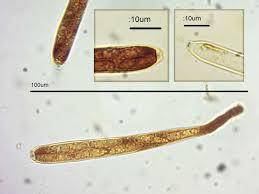 Attēlu rezultāti vaicājumam “Cudoniella clavus”