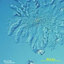 Attēlu rezultāti vaicājumam “Mycosphaerella millegrana”