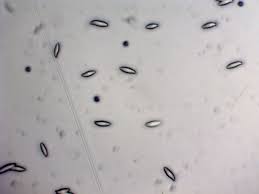 Attēlu rezultāti vaicājumam “Tremellodendropsis tuberosa”