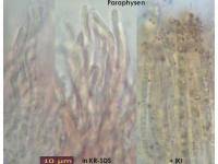 Attēlu rezultāti vaicājumam “Hyphodiscus hymeniophilus”