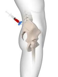 Image result for BMAC