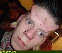 Body Modification Forehead Implants :: Wtf Pictures