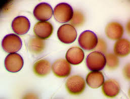 Attēlu rezultāti vaicājumam “Lamproderma pseudomaculatum”