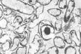 Clostridium acetobutylicum - MicrobeWiki