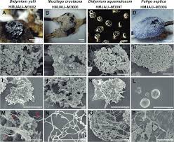 Attēlu rezultāti vaicājumam “Didymium spongiosum spores”