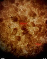 Attēlu rezultāti vaicājumam “Lycogala ustulatum macro”