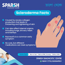 Attēlu rezultāti vaicājumam “Scleroderma”