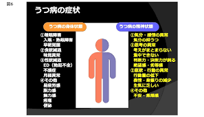 Image result for うつ病 亜型分類