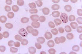 Attēlu rezultāti vaicājumam “Enteridium variabile plasmodium”