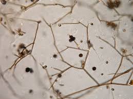 Attēlu rezultāti vaicājumam “Ochropsora ariae spores”