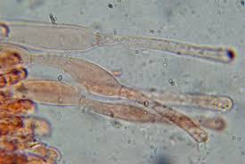 Attēlu rezultāti vaicājumam “Peziza varia”