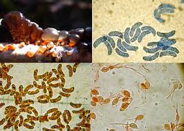 Attēlu rezultāti vaicājumam “Exidia truncata”