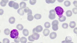Attēlu rezultāti vaicājumam “Cribraria purpurea plasmodium”
