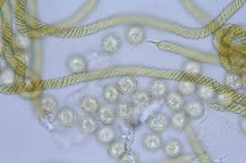 Attēlu rezultāti vaicājumam “Trichia scabra spores”