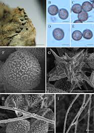 Attēlu rezultāti vaicājumam “Didymium spongiosum spores”