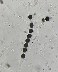 Attēlu rezultāti vaicājumam “Biscogniauxia marginata”