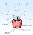 Subacute <b>thyroiditis</b>