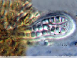 Attēlu rezultāti vaicājumam “Arthonia leucopellaea”